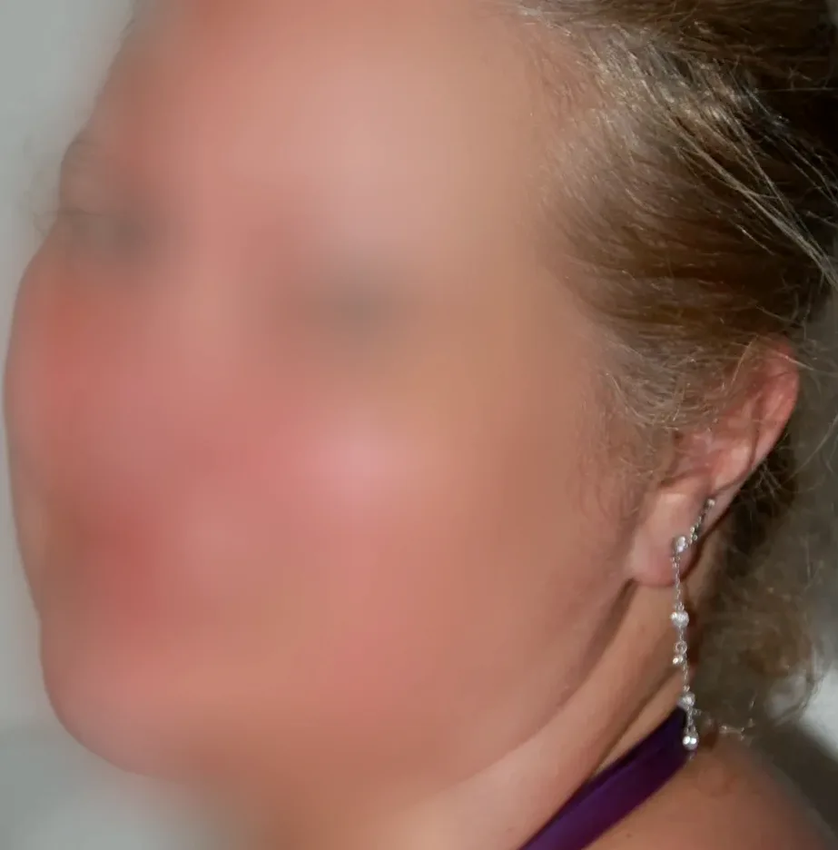 Stacey, 28